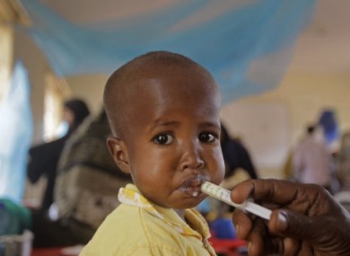 An unidentified child receives treatment for malnutrition in Kenya.
