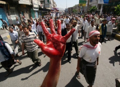 A protestor displays his hand painted in red to symbolize bloodshed during a demonstration demanding the resignation of Yemeni President Ali Abdullah Saleh in Taiz, Yemen, on Saturday