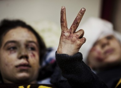 Hana, 12, flashes the victory sign next to her sister Eva, 13, as they recover from severe injuries after the Syrian Army shelled their house in Idlib. Their father and two siblings were killed during the attack.