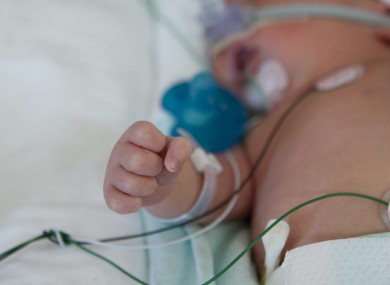 Premature babies can face health risks