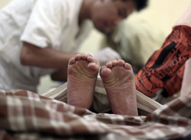 A boy's toes curl in pain as a doctor performs circumcision on him. Germany has banned the practice when carried out on young boys on religious grounds.
