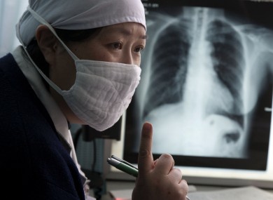 A doctor talks to a patient suspected to have tuberculosis at the Beijing Chest Hospital, file photo